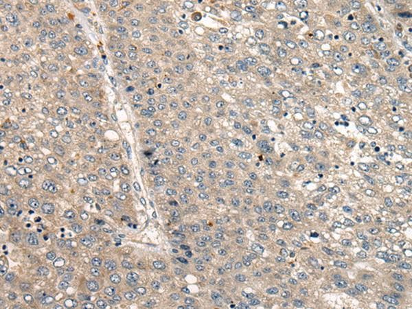 Polyclonal Rabbit anti-Human CC2D1A Antibody (IHC)