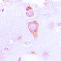 Polyclonal Rabbit anti-Human GUCY1B3 Antibody (N-Terminus, IHC, WB)