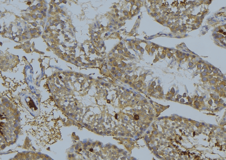 MAP3K8 / TPL2 Antibody