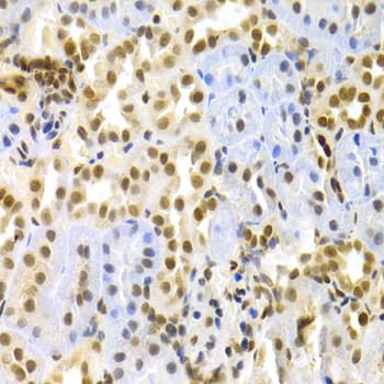 Polyclonal Rabbit anti-Human MAPK3 / ERK1 Antibody (IHC, IF, WB)