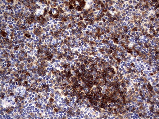 Monoclonal Mouse anti-Human CD79A / CD79 Alpha Antibody (clone OTI3D3, IHC, WB)