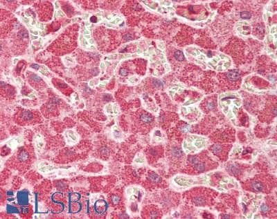 Polyclonal Rabbit anti-Human PIK3C3 / VPS34 Antibody (Ser851, IHC, WB)