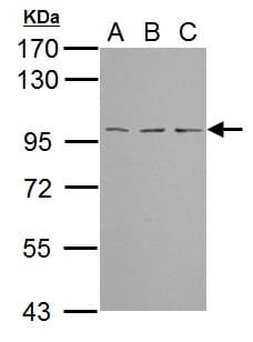 TBCK / TBCKL Antibody (aa457-694)