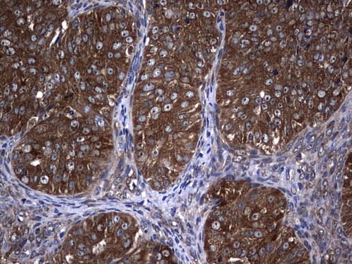 Monoclonal Mouse anti-Human NME1 / NM23 Antibody (clone UMAB92, IHC, IF, WB)