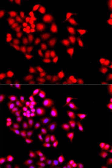 Polyclonal Rabbit anti-Human STXBP2 Antibody (IF, WB)