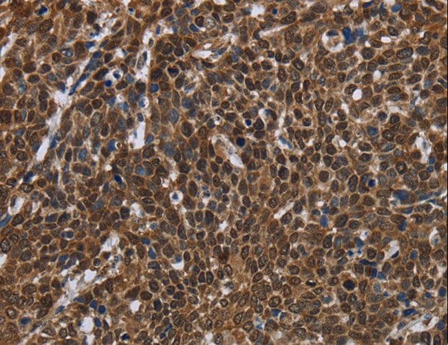FASTKD2 Antibody