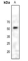 Polyclonal Rabbit anti-Human PAX6 Antibody (WB)