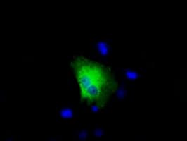 RIP1 / RALBP1 Antibody (clone OTI6E8)