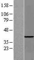 PSMD7 / MOV34 Protein (Over-Expression Lysate Myc-DDK (Flag))