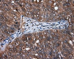 Monoclonal Mouse anti-Human HMRF1L / MTRF1L Antibody (clone OTI1H5, IHC, IF, WB)