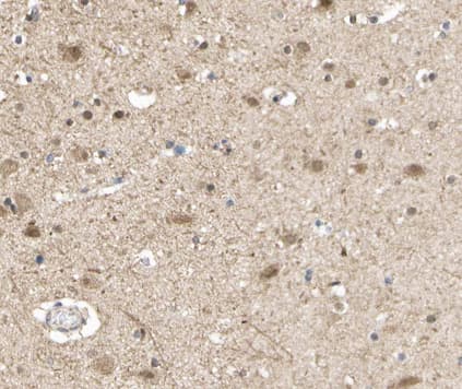 Polyclonal Rabbit anti-Human S100A1 / S100-A1 Antibody (IHC, IF, WB)