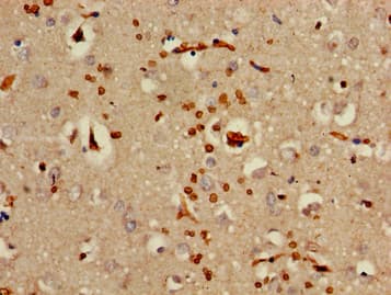 OAS3 / p100 Antibody