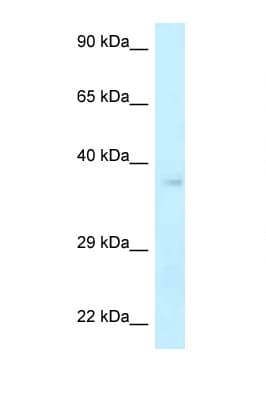 Polyclonal Rabbit anti-Human NHEJ1 / XLF Antibody (C-Terminus, WB)