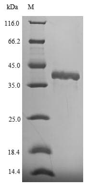 Mouse Fgf15 Protein (Recombinant 6His-SUMO, N-terminus)