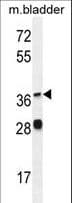 IHC-plus™ Polyclonal Rabbit anti-Human FADS1 Antibody (aa303-332, IHC, WB)