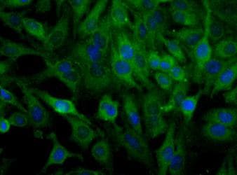 SCARB1 / SR-BI Antibody (DY650)