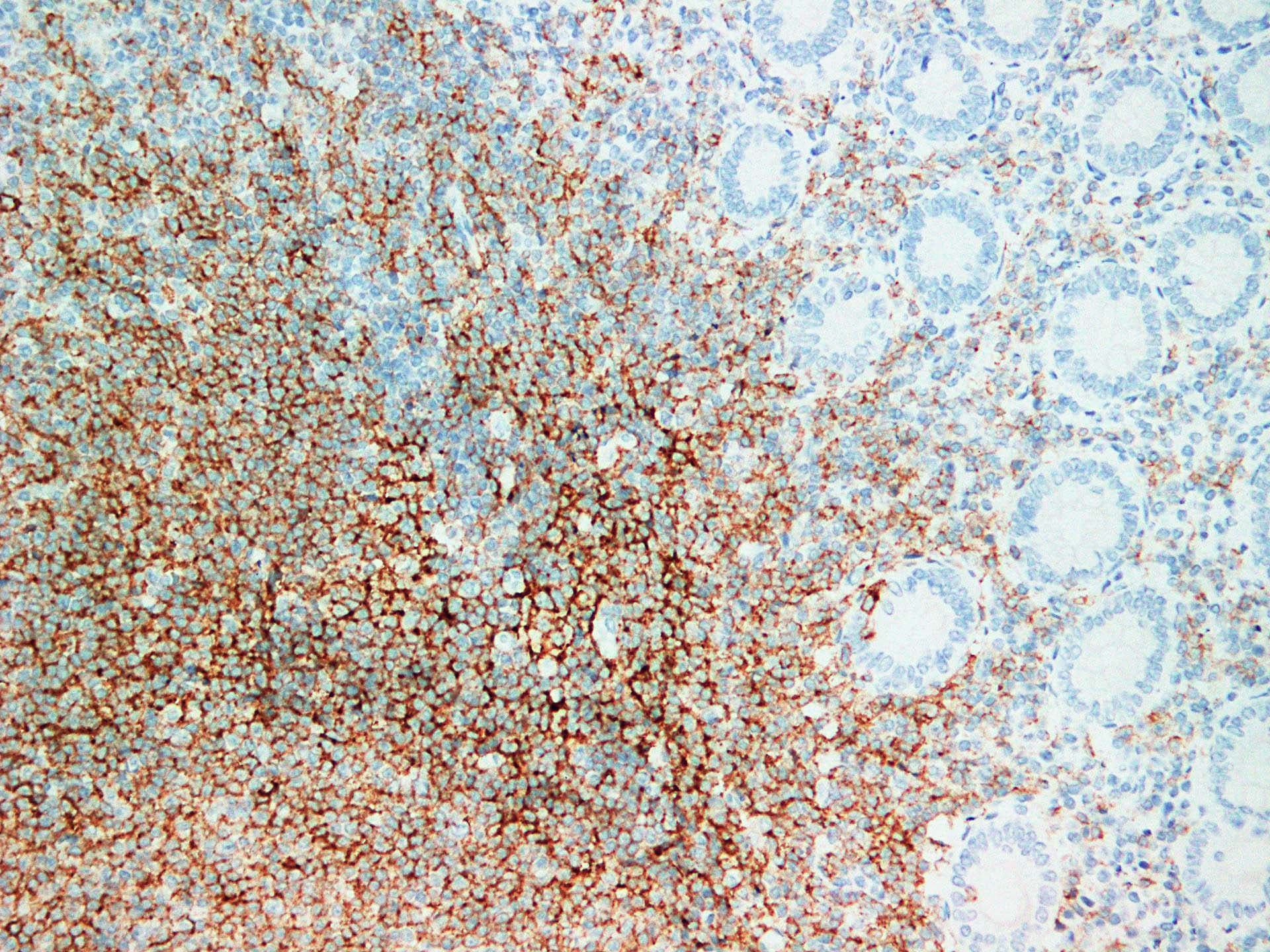CD20 Antibody (clone ABT-CD20)