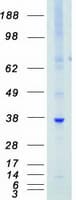 Human PIM1 / Pim-1 Protein (Recombinant Myc-DDK (Flag))