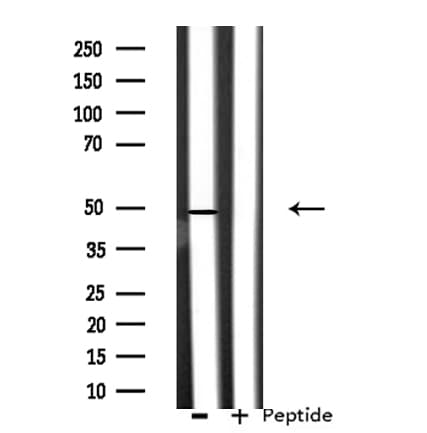 CSTF1 Antibody