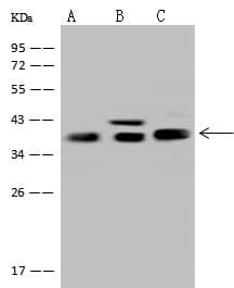 ALDOC / Aldolase C Antibody