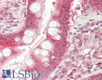 IHC-plus™ NRP1 / Neuropilin 1 Antibody