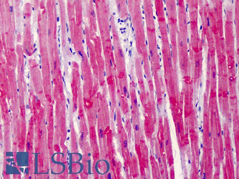 PathPlus™ TNNT2 / CTNT Antibody (aa100-200)