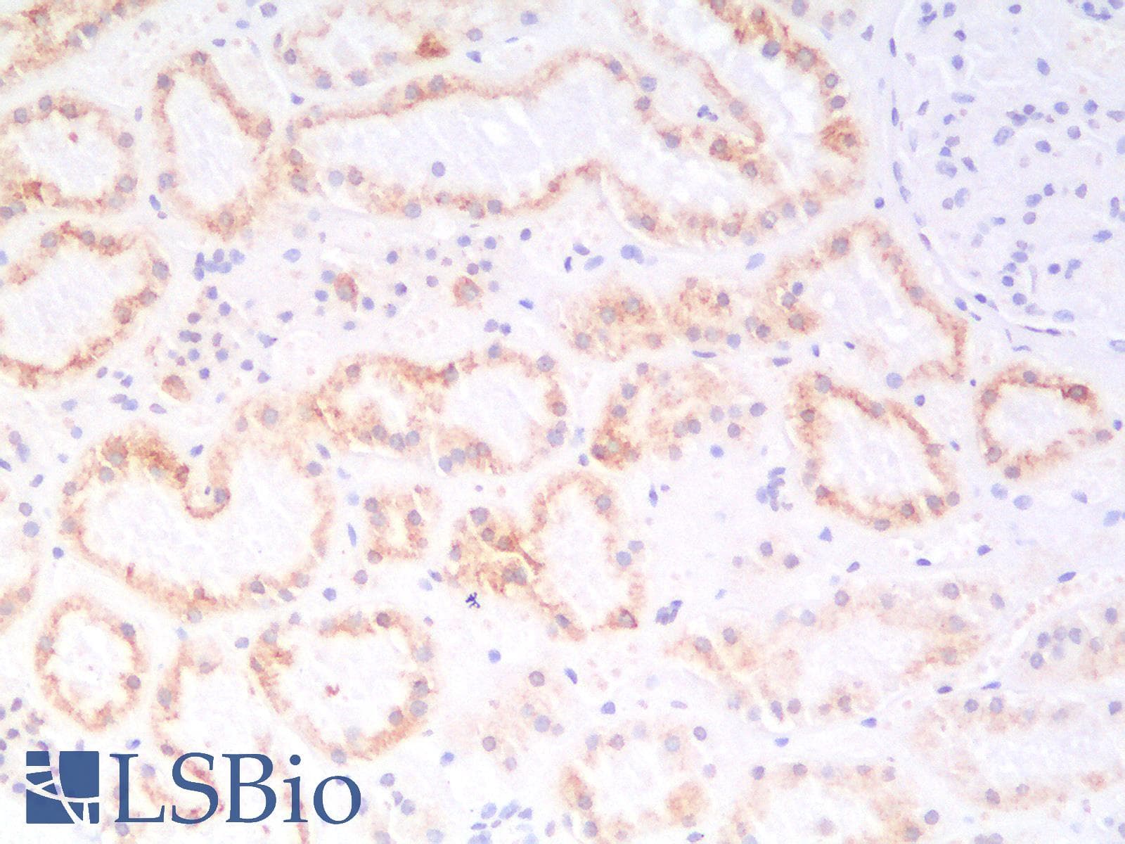 IHC-plus™ KRT18 / CK18 / Cytokeratin 18 Antibody (clone KRT18/2819R)