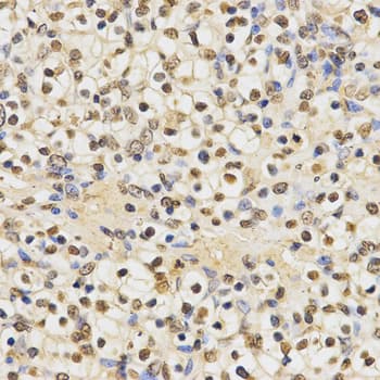 Polyclonal Rabbit anti-Human Histone H3 Antibody (Methyl-Lys27, IHC, IF, WB)