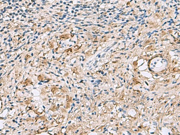 TMEM141 Antibody