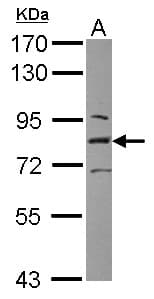 L3MBTL1 Antibody