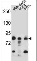 AFG3L2 Antibody (aa52-80)