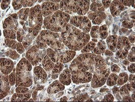 Monoclonal Mouse anti-Human PIK3CG / PI3K Gamma Antibody (clone OTI2B1, IHC, WB)