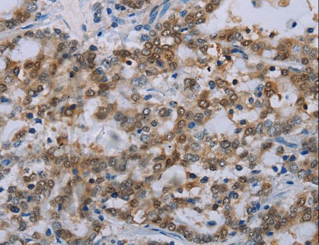 MED12 Antibody