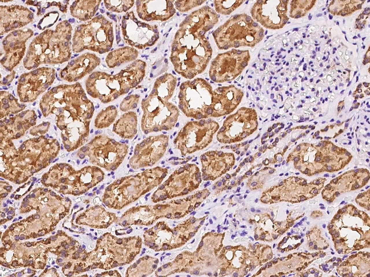 MRPS5 Antibody