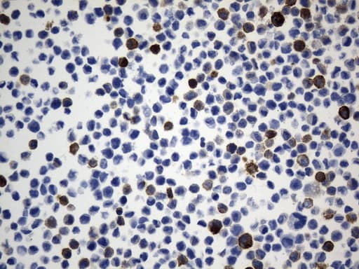ACTA2 / Smooth Muscle Actin Antibody (N-Terminus, clone UMAB237)
