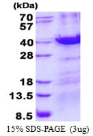 Human MBD3 Protein (Recombinant His)