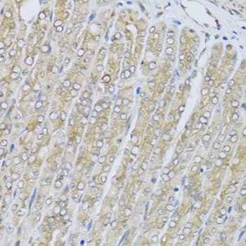 Polyclonal Rabbit anti-Human HRG Antibody (IHC, WB)