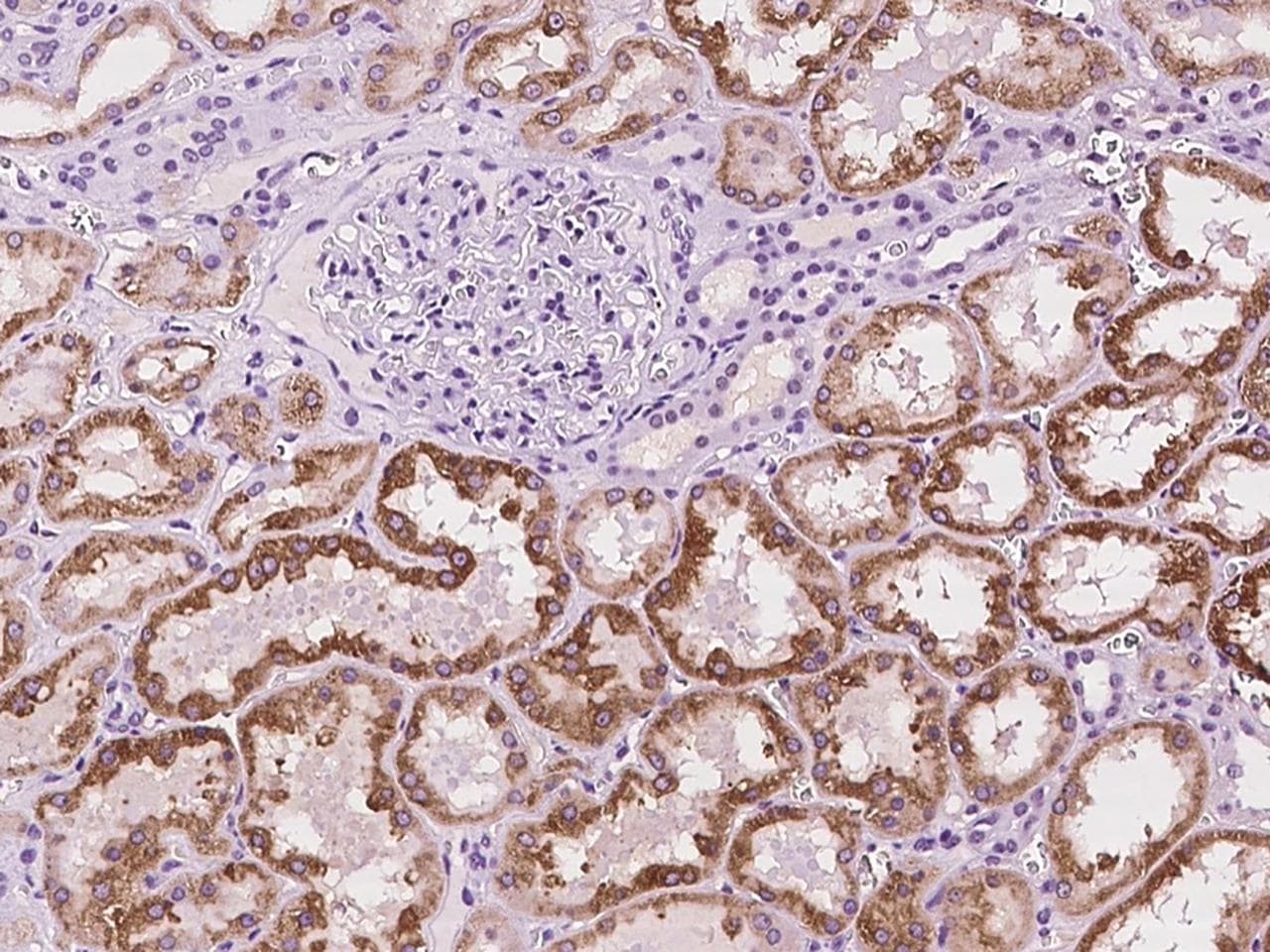 Polyclonal Rabbit anti-Human CLEC14A Antibody (IHC)