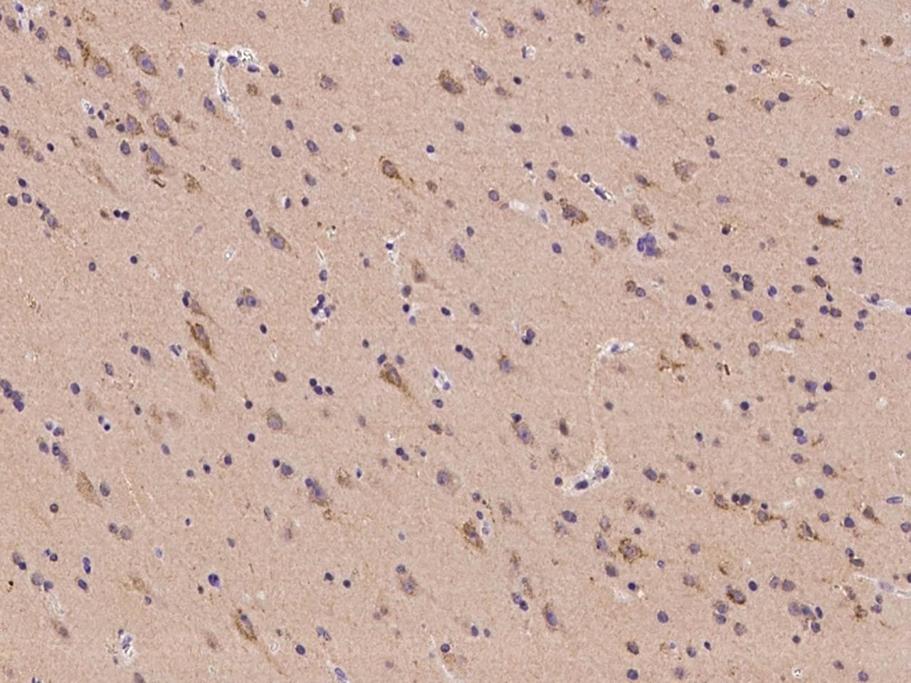 FAM161B Antibody