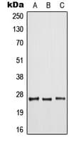 ARF6 Antibody (Internal)