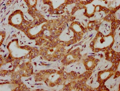 HBG2 / Hemoglobin Gamma 2 Antibody