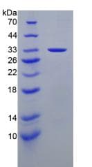 Human LAMA3 / Laminin Alpha 3 Protein (Recombinant 6His, N-terminus)