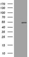 Monoclonal Mouse anti-Human CD4 Antibody (clone OTI5C2, IHC, WB)