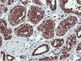 PSMB7 Antibody (clone OTI1E1)
