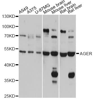 AGER / RAGE Antibody