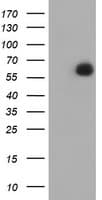 IHC-plus™ Monoclonal Mouse anti-Human PPAT Antibody (clone 3C6, IHC, WB)