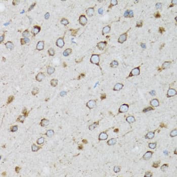 UBE2D1 / UBCH5 Antibody