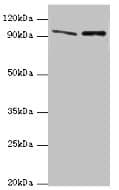 Polyclonal Rabbit anti-Human NVL Antibody (aa340-520, IHC, WB)