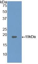 MBOAT5 / C3F Antibody (aa122-233, PE)