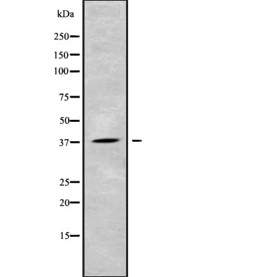 Polyclonal Rabbit anti-Human CEACAM8 / CD66b Antibody (IHC, WB)